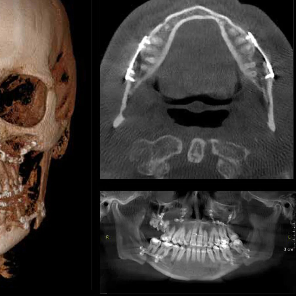 3.3D Rekonstrüksiyon ve Analiz