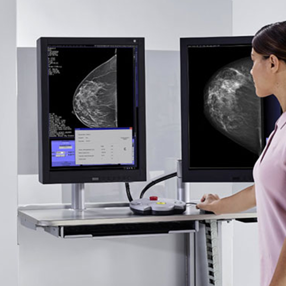 3.Görüntüleme ve Raporlama