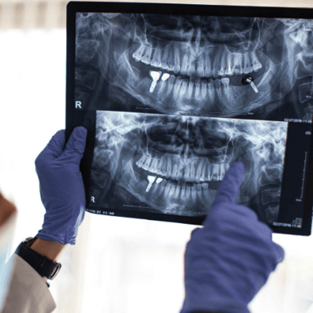 3.Görüntüleme ve Raporlama